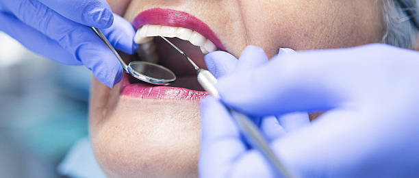 Best Broken or Chipped Tooth Repair in Brownlee Park, MI