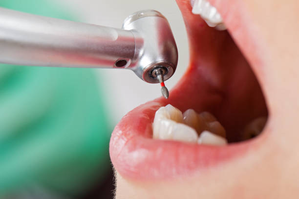Best Emergency Dental Care for Sports Injuries in Brownlee Park, MI